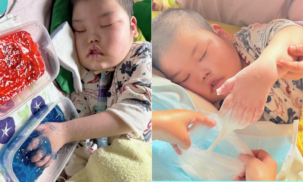 居宅訪問型児童発達支援